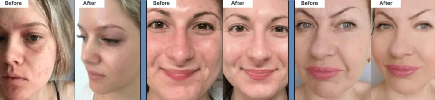 Glokore Gua Sha Benefits