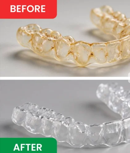 DentaSonic Ultrasonic Retainer Cleaner Before & After